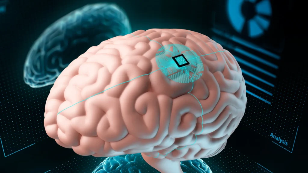 Neuralink: Primeiro implante de chip cerebral em humano